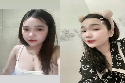 Em dâm bị nhổ lôi cho nước chảy đầy